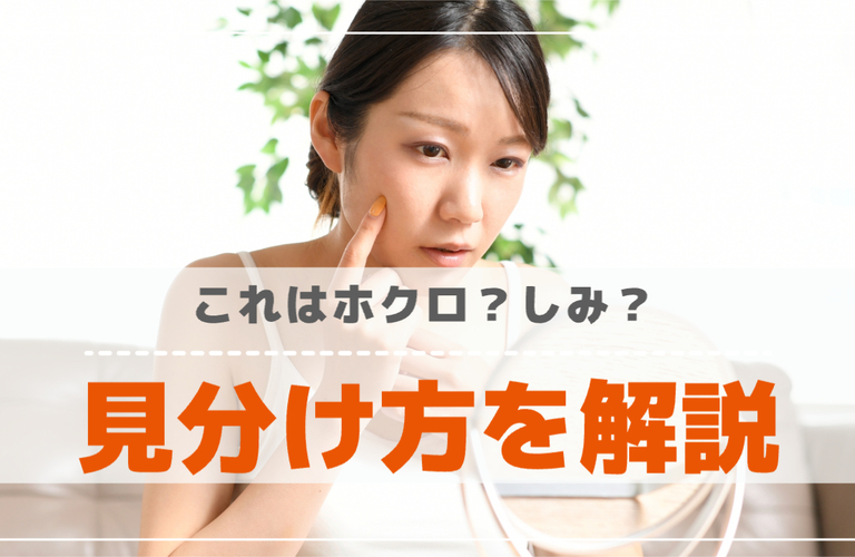 ホクロとシミの違いや見分け方を分かりやすく解説