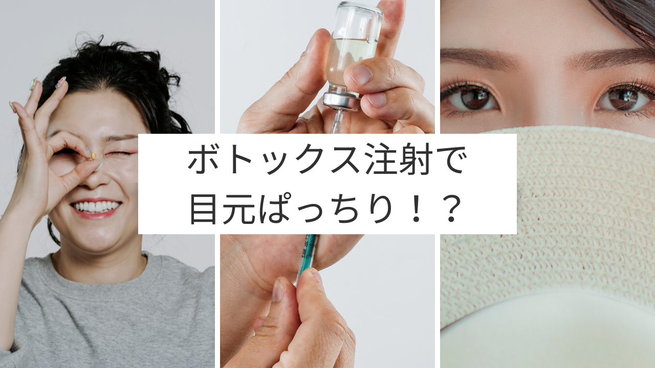 ボトックス 目 ぱっちり