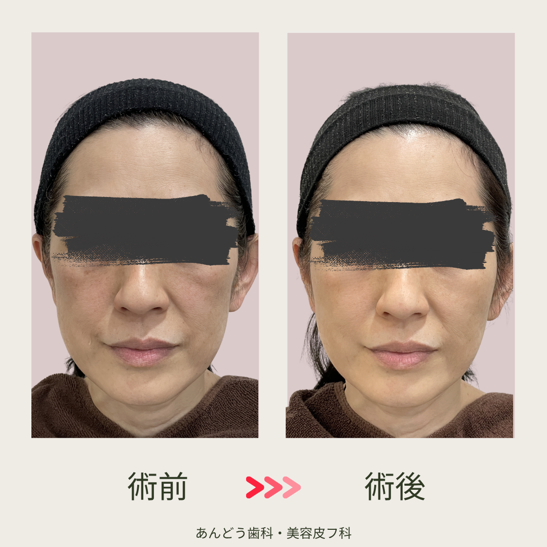 ダウンロード (9)
