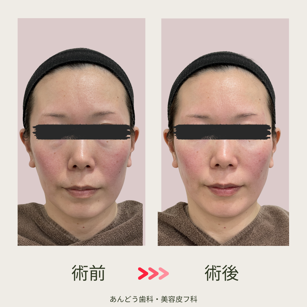 ダウンロード (9)